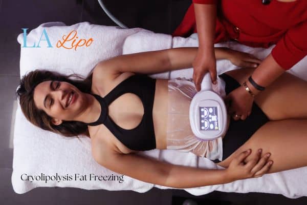 woman getting cryolipolysis Swinton