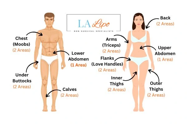 LA LIPO Cryolipolysis Areas Swinton